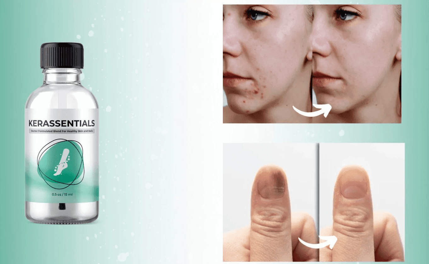 Kerassentials health skin, and nails support